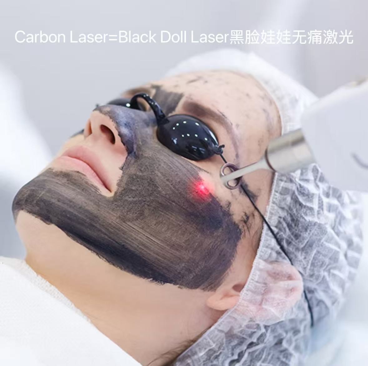 Carbon laser